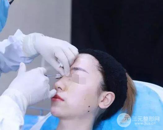 瑞兰隆鼻多少钱 瑞兰隆鼻真实一个月恢复前后对比图案例