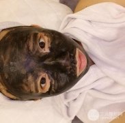 黑脸娃娃降低风险吗？做一个疗程多少钱？