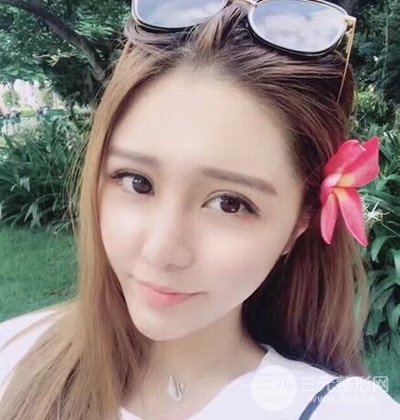 隆鼻整形+埋埋蛋白线.提升+自体脂肪全脸填充术后改头换面！