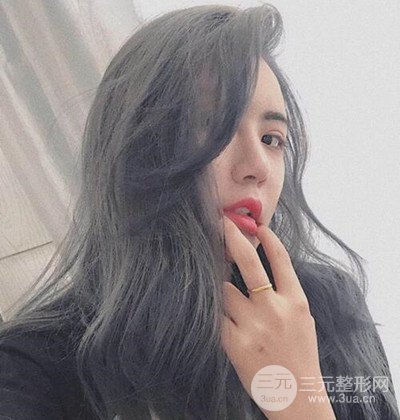 隆鼻整形+埋埋蛋白线.提升+自体脂肪全脸填充术后改头换面！