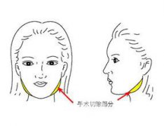 咬肌大怎么办 B****果怎么样