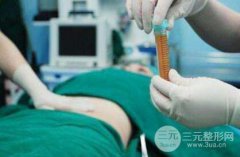 腹部共振吸脂手术的价格是多少呢