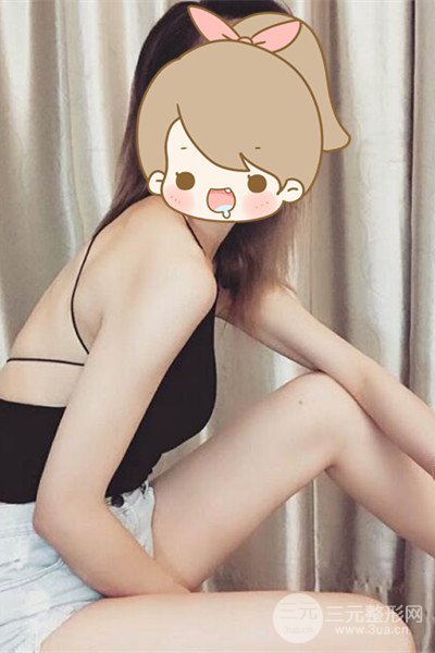 梨型身材做了大腿吸脂之后果超明X，吸脂恢复过程分享
