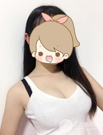 北京自体脂肪隆胸手术日记分享，丰胸术后恢复果图