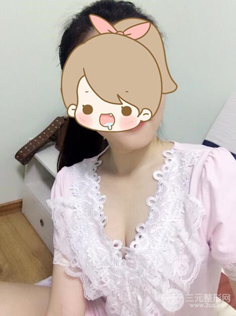 北京自体脂肪隆胸手术日记分享，丰胸术后恢复果图