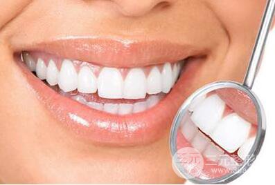 烤瓷牙的种类及价钱