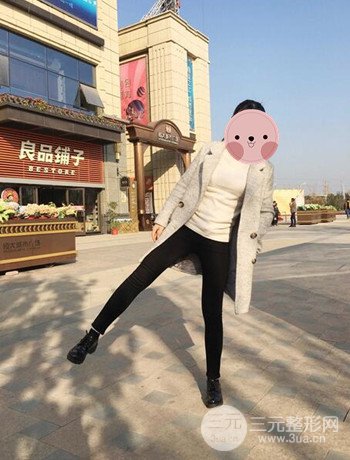 吸脂瘦大腿手术经历分享，纤细双腿不再是梦