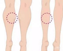 注射瘦脸一针多少钱?果好不好?