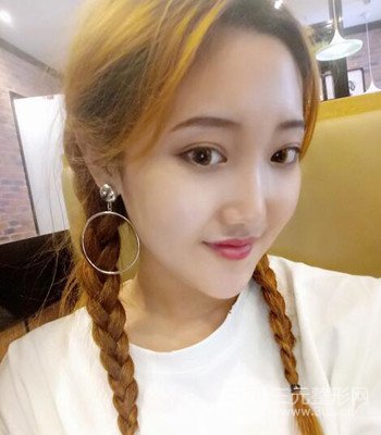 终于做了下颌角整形，分享术后恢复果