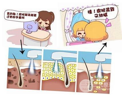光子嫩肤价格是多少 适合哪些人群