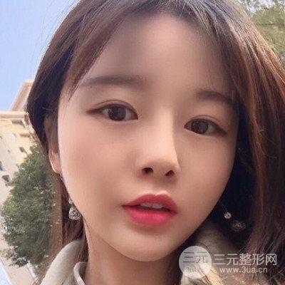 做了牙齿冷光美白果很棒，绽放美丽笑容