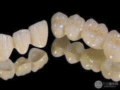 贵金属烤瓷牙的价格，多少钱呢?