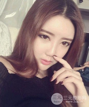 全脸自体脂肪填充手术日记分享，改良脸型年轻十岁