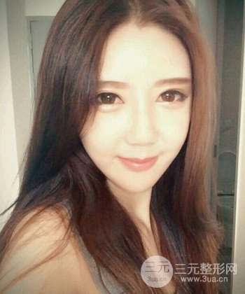 全脸自体脂肪填充手术日记分享，改良脸型年轻十岁