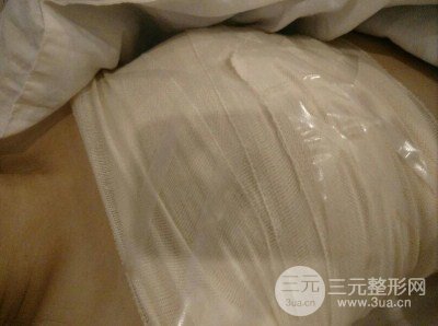 平胸妹做了假体隆胸果分享，丰满身材不是梦