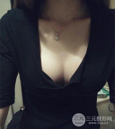 平胸妹做了假体隆胸果分享，丰满身材不是梦