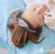 瑞兰玻尿酸注射苹果肌术后果图片 瑞兰玻尿酸注射苹果肌术后果图片