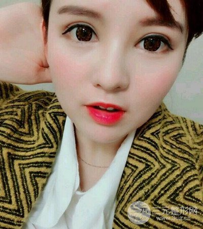 隆鼻整形手术个人经历分享，精致小翘鼻不是梦