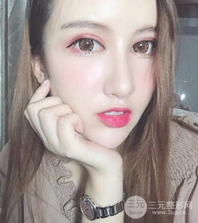 隆鼻整形手术个人经历分享，精致小翘鼻不是梦