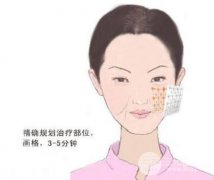 塑m极危害有哪些?副作用?