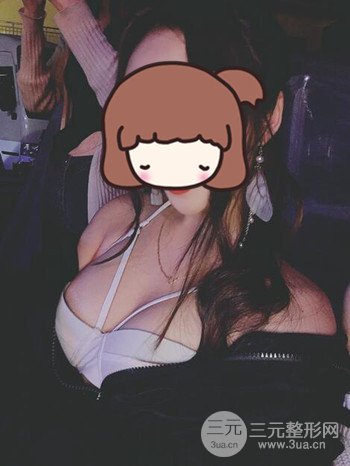 职业模特做了假体隆胸手术分享手术恢复照片