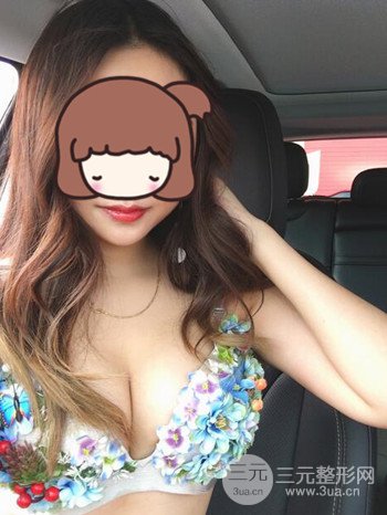 职业模特做了假体隆胸手术分享手术恢复照片