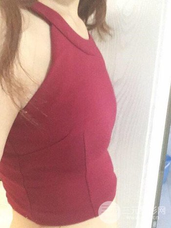 假体隆胸术后成功摆脱小学生身材，立现性感身材