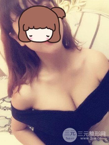 假体隆胸术后成功摆脱小学生身材，立现性感身材