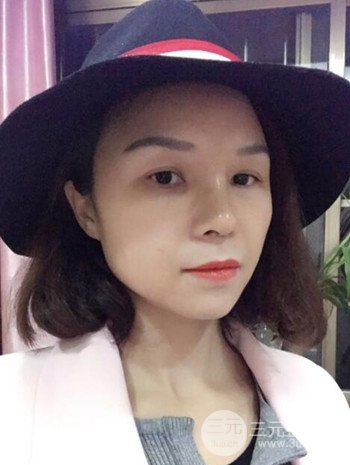 隆鼻整形手术真人案例恢复过程分享 附上果图