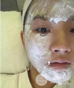 电波l皮真人案例前后对比图分享 体验真实果