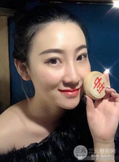 北京伊美尔徐军隆鼻整形前后对比照片心情记录小札