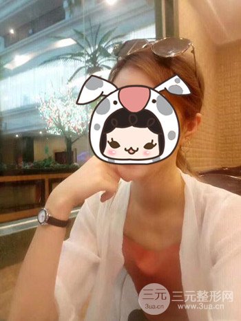 健身教练做了假体隆胸拥有凹凸有致的身材