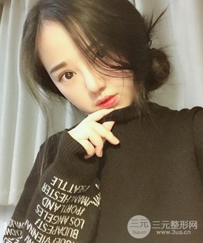 做了隆鼻整形成功落实精致小巧鼻 附上果图