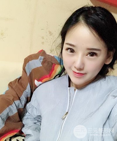 做了隆鼻整形成功落实精致小巧鼻 附上果图