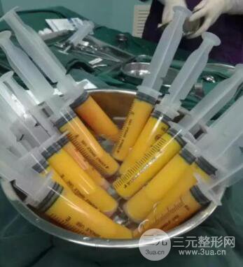 自体脂肪去眉间纹术后护理工作主要有些什么？