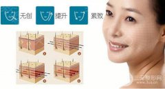 蛋白线面b提升多少钱? 蛋白线面b提升多少钱?
