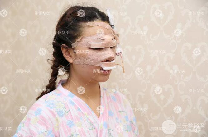 贵阳华美郭宗科全切双眼皮+假体隆鼻案例前后对比图 华美员工全脸整形实录