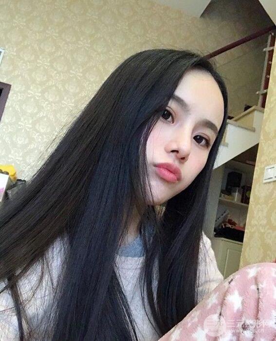 成都大华隆鼻怎么样?真实案例前后对比图记录恢复过程