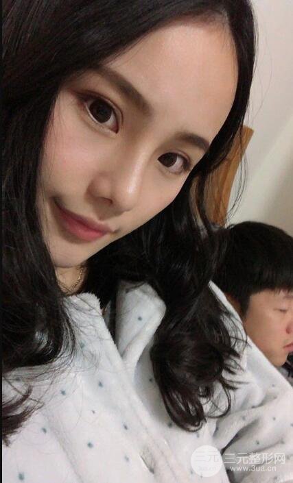 成都大华隆鼻怎么样?真实案例前后对比图记录恢复过程