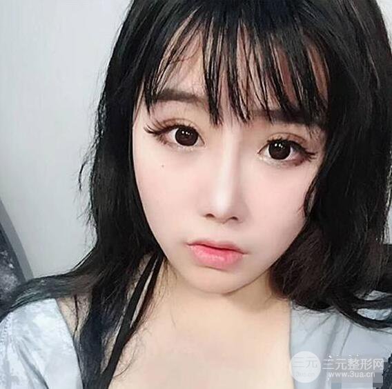 合肥壹加壹甘泉涌软骨隆鼻前后对比图|内附真人案例恢复前过程