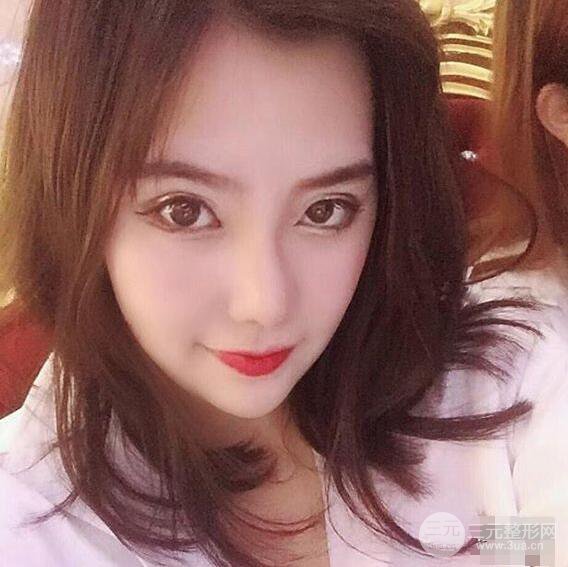 合肥壹加壹甘泉涌软骨隆鼻前后对比图|内附真人案例恢复前过程