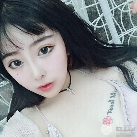 合肥壹加壹甘泉涌软骨隆鼻前后对比图|内附真人案例恢复前过程