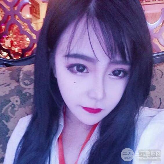 合肥壹加壹甘泉涌软骨隆鼻前后对比图|内附真人案例恢复前过程