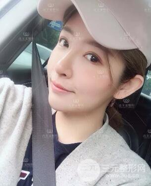 南京连天美整形周长兵隆鼻整形真人案例前后对比图|内附恢复过程心情日扎