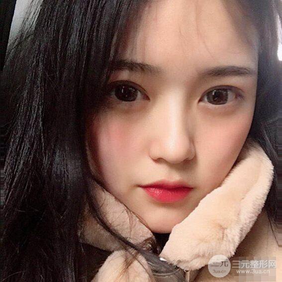 浙一医院美容科吴慧玲单眼皮割双眼皮前后对比图|单眼皮的秘密武器