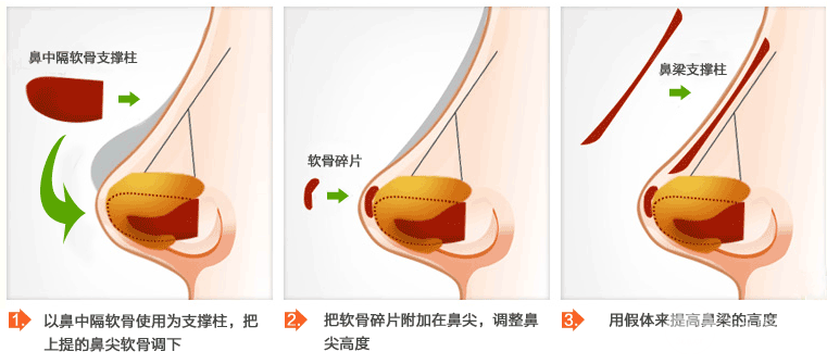 天津维美整形医院价格表医生口碑完整曝光一览