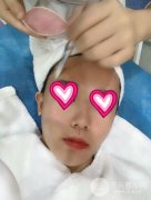 果酸换肤的功有哪些？缓解过程分享！