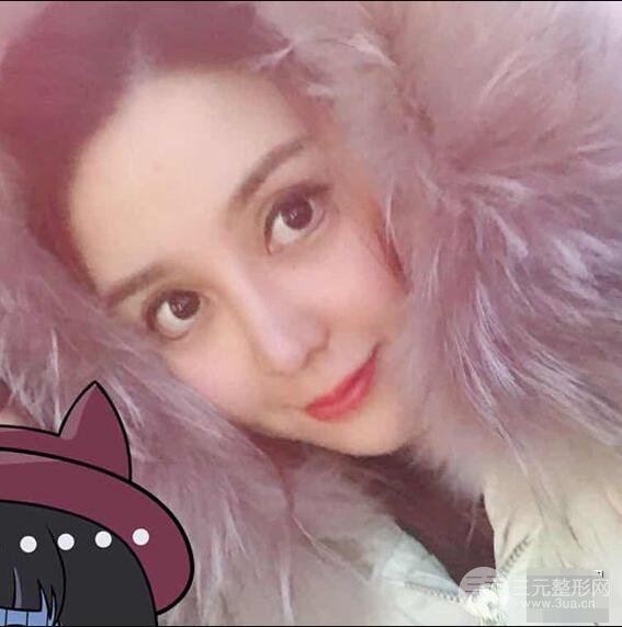 昆明吴氏嘉美李明硅胶隆鼻前后对比图恢复心情小札