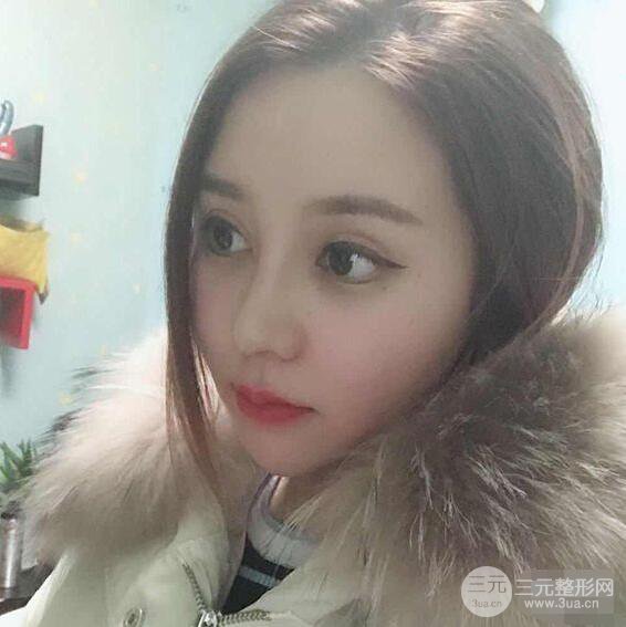 昆明吴氏嘉美李明硅胶隆鼻前后对比图恢复心情小札