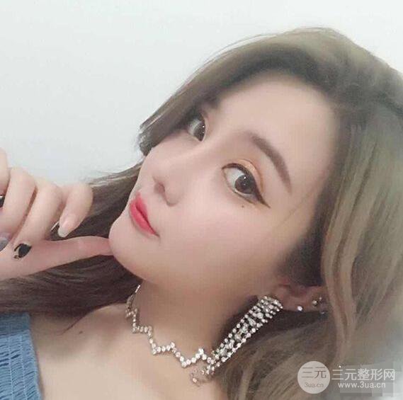 昆明吴氏嘉美李明硅胶隆鼻前后对比图恢复心情小札